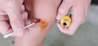 iodine crystals powder Diverse Application Fields iodine crystals powder Diverse Application Fields